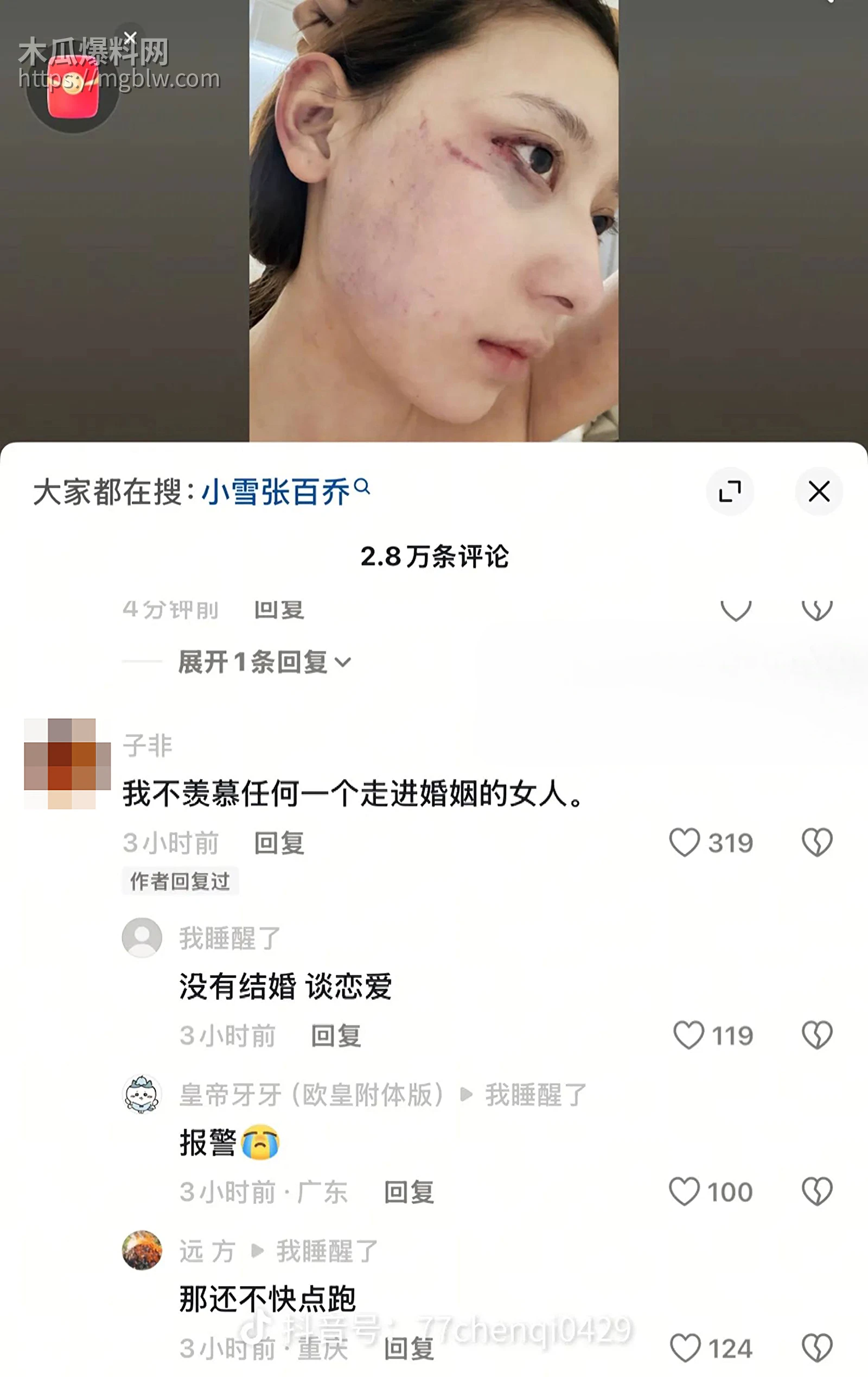 千万大V张百乔家暴视频被扒 22 拷贝