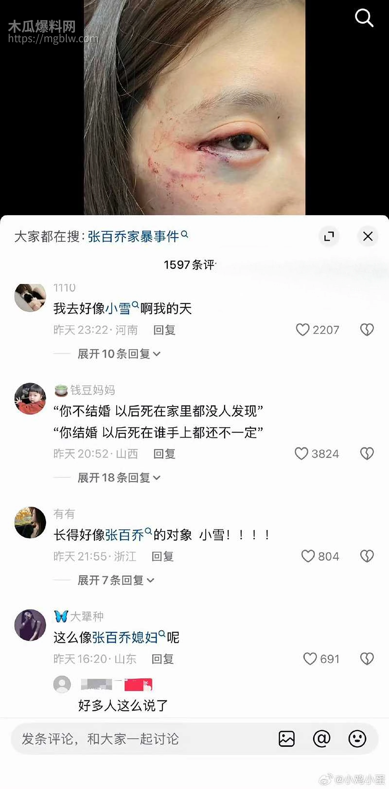 千万大V张百乔家暴视频被扒 23 拷贝