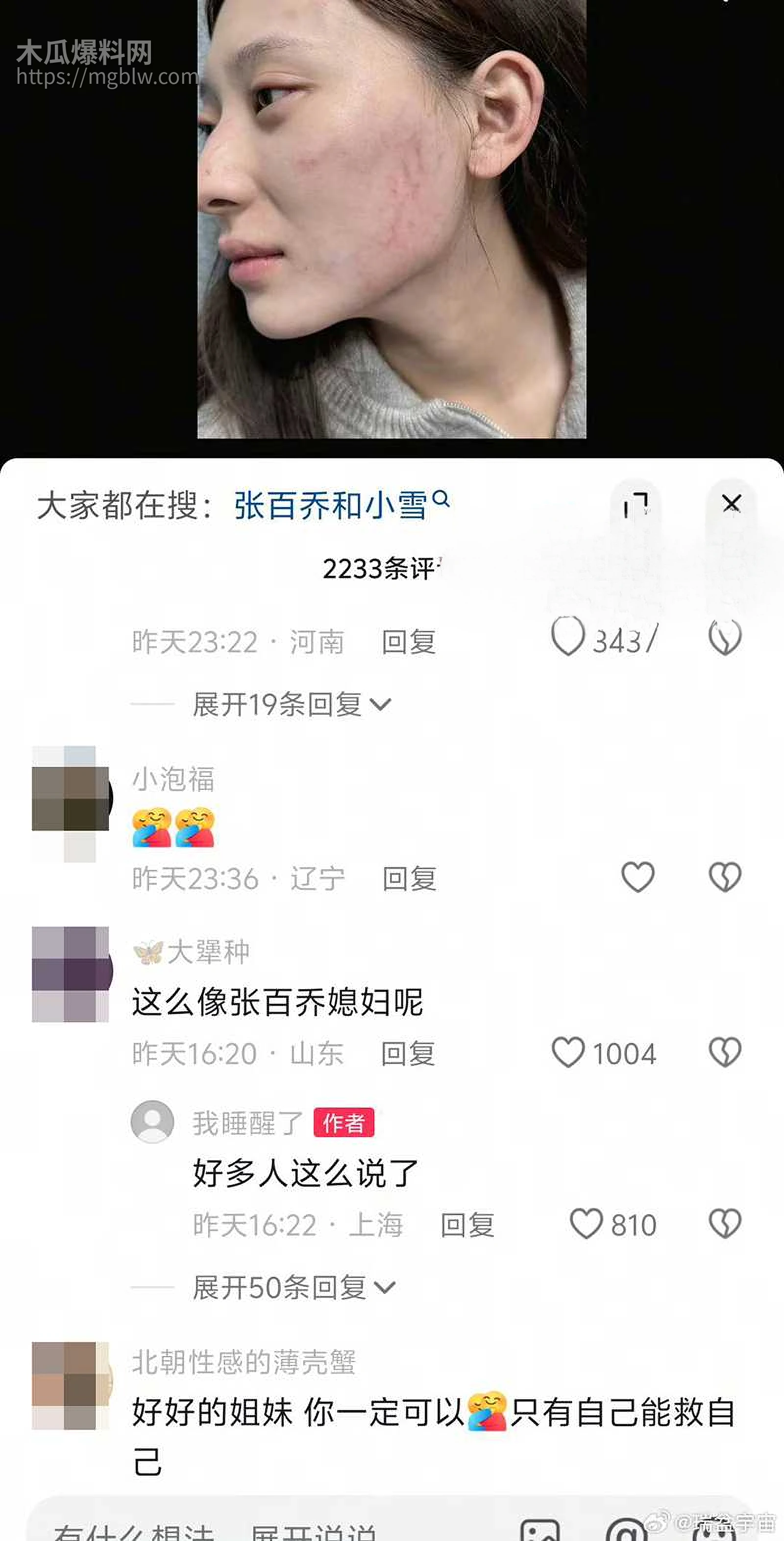 千万大V张百乔家暴视频被扒 24 拷贝