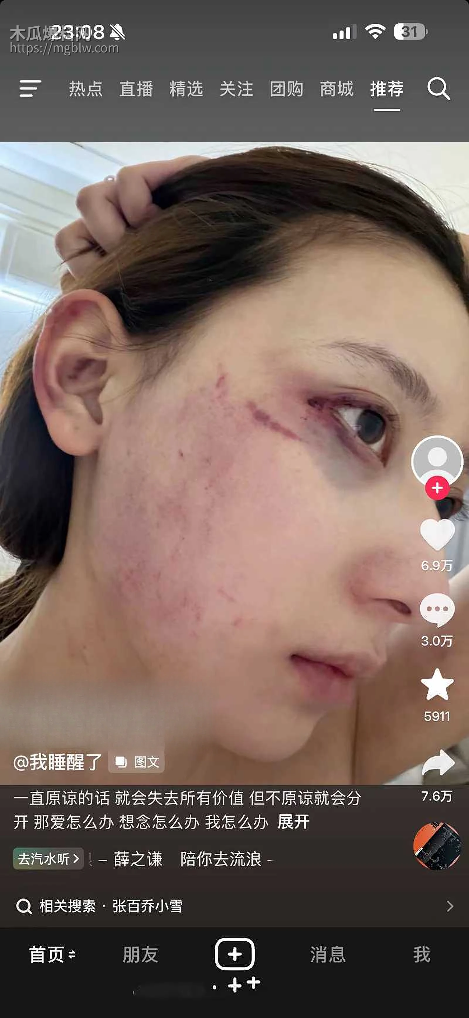 千万大V张百乔家暴视频被扒 27 拷贝