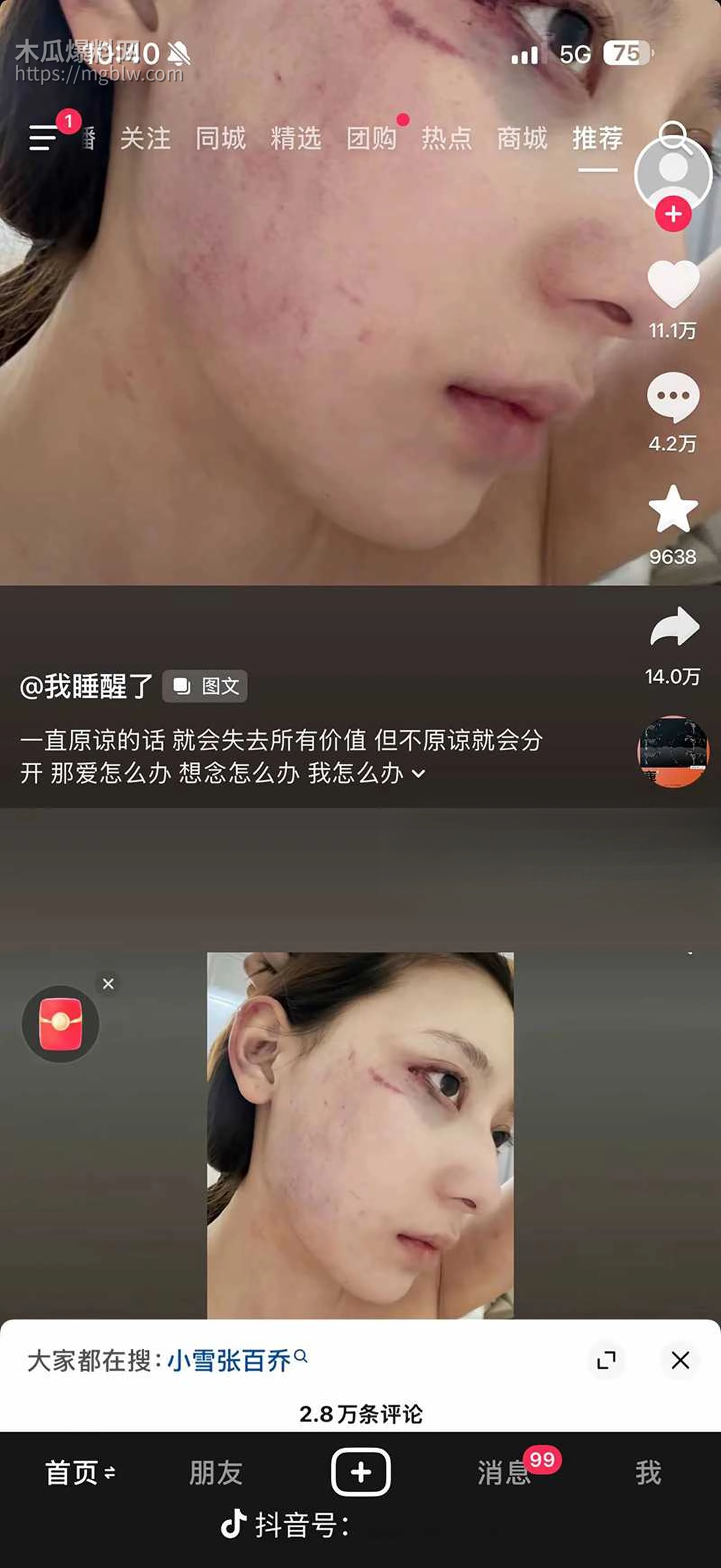 千万大V张百乔家暴视频被扒 28 拷贝