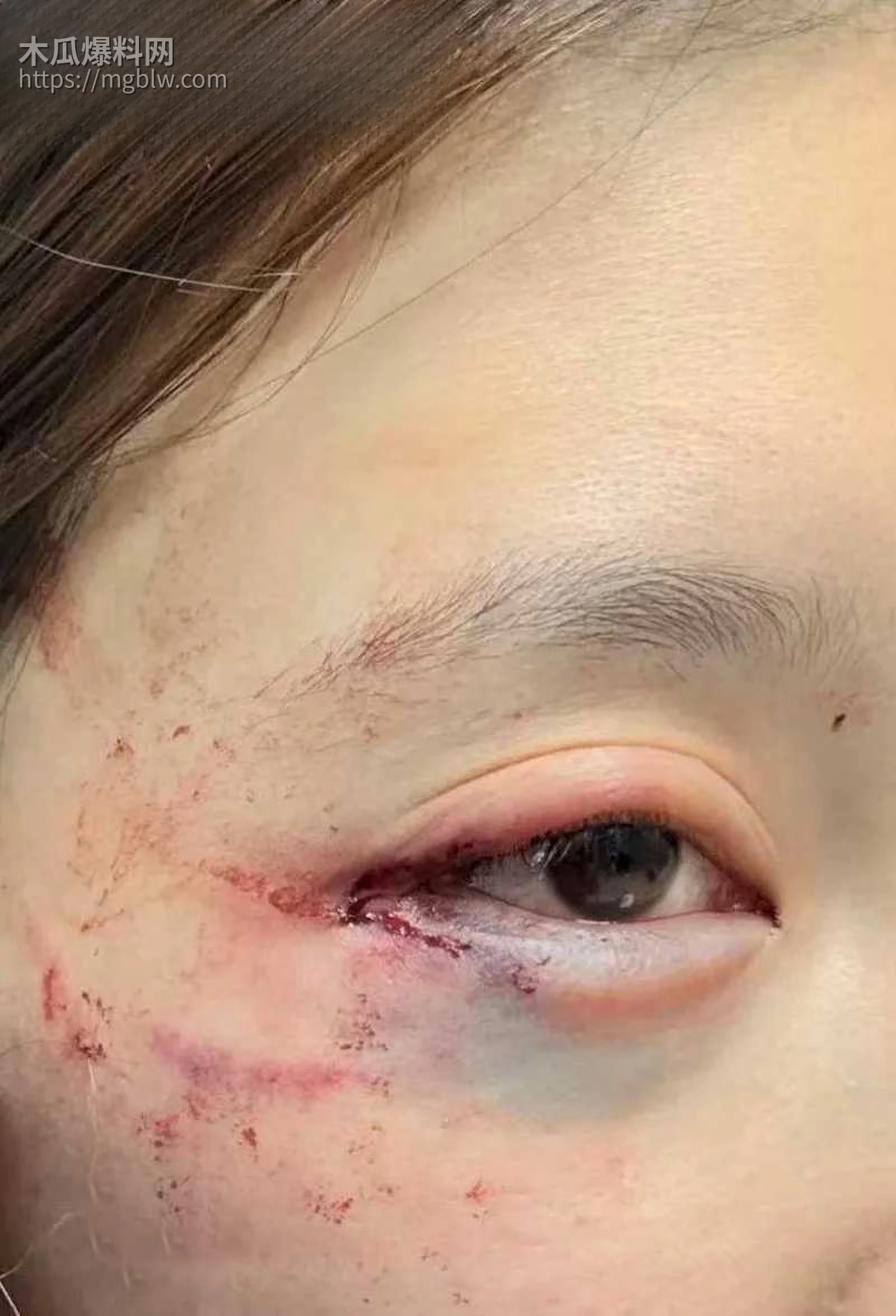 千万大V张百乔家暴视频被扒 32 拷贝